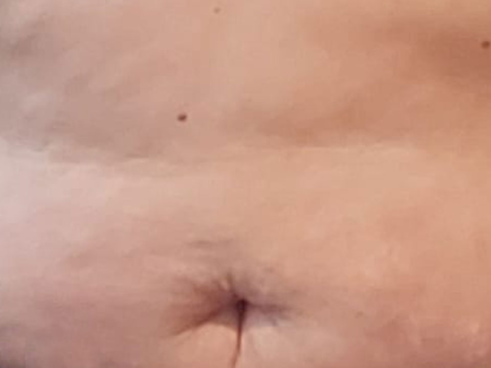 belly button 3