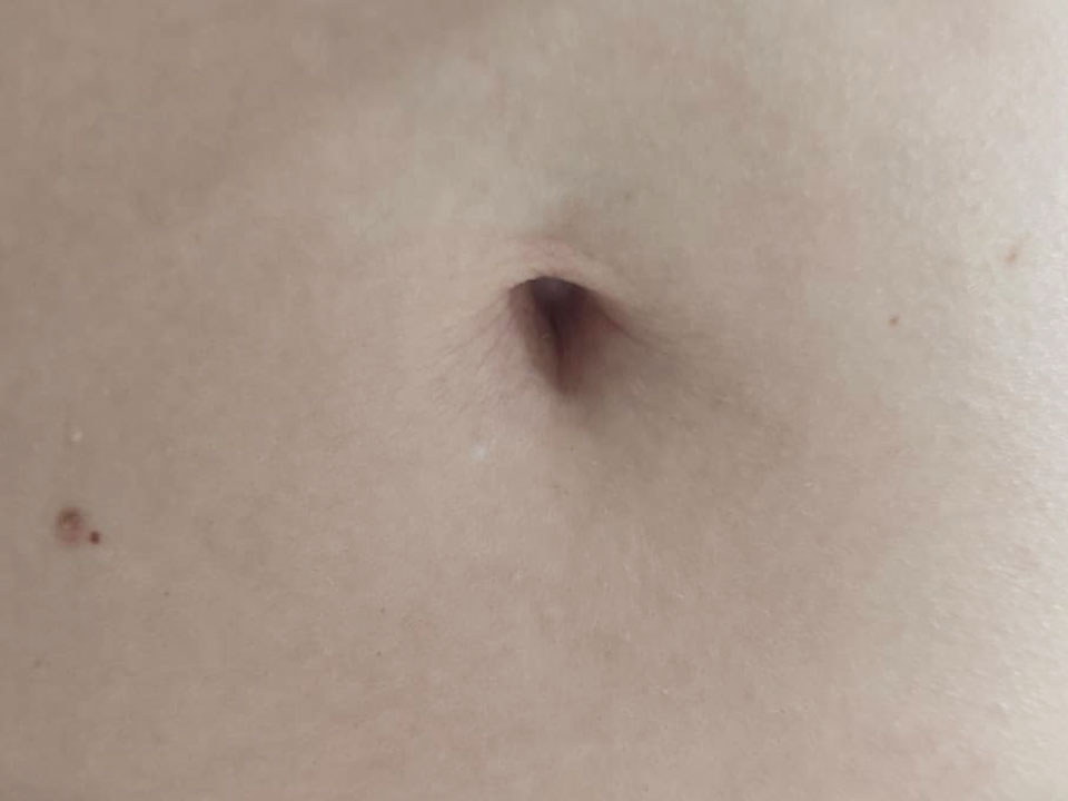 belly button 8