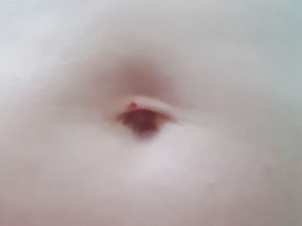 belly button 10