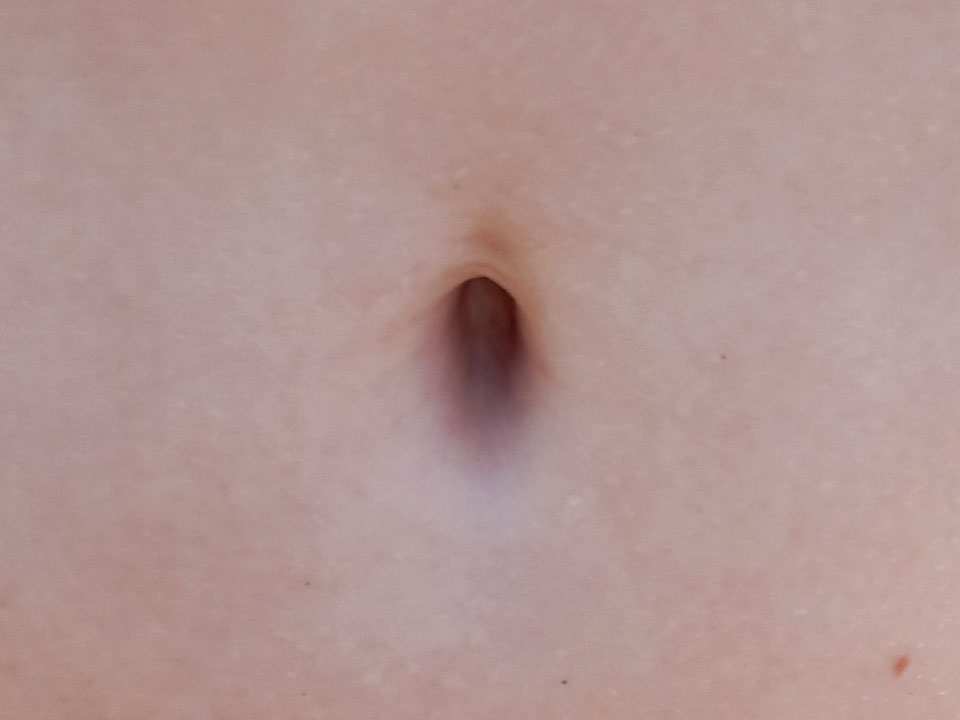 belly button 11