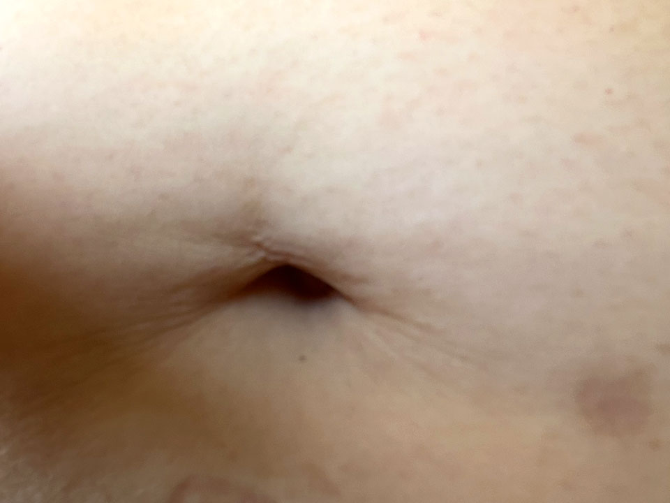 belly button 13