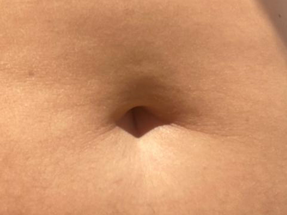belly button 15