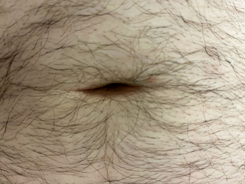 belly button 4