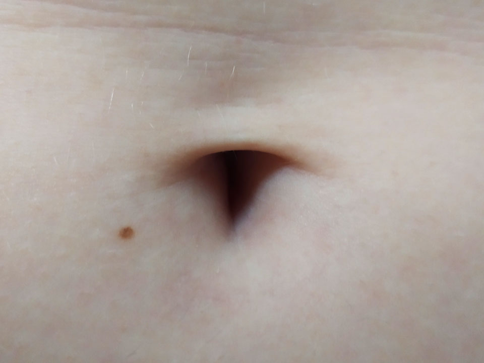 belly button 2
