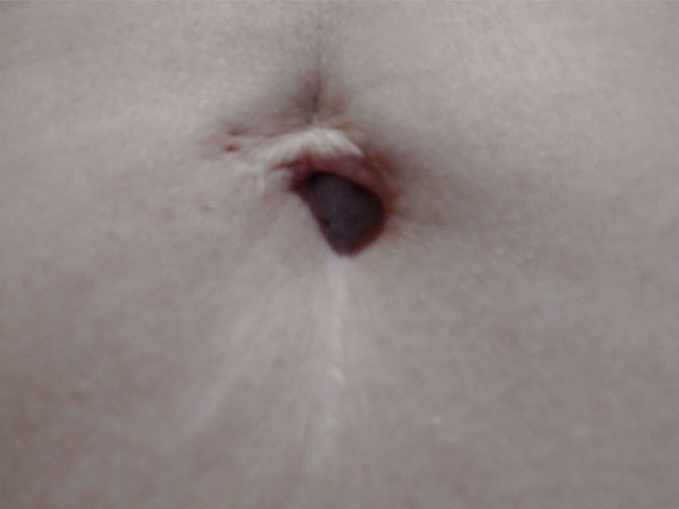 belly button 1