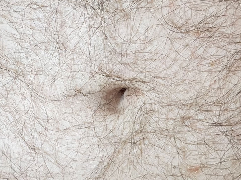 belly button 18